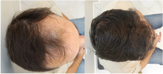 Antes x Depois 3