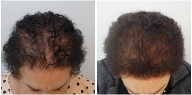Antes x Depois 5