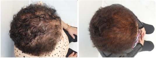 Antes x Depois 6