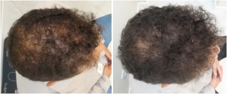 Antes x Depois 8